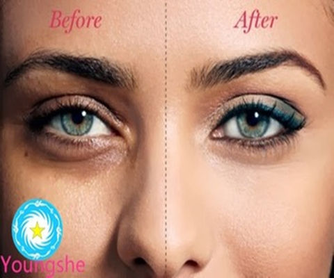 Eyecare Peptide Yellow-White Color Haloxyl Palmitoyl Oligopeptide