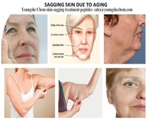 Skin Care Peptide  Ucpeptide V /pentapeptide-25 for Cellulite slimming